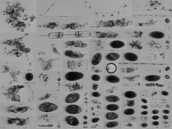 Some of the phytoplankton images that can be captured by the IFCB. McLane Research Laboratories, Inc. Some of the phytoplankton images that can be captured by the IFCB. McLane Research Laboratories, Inc.