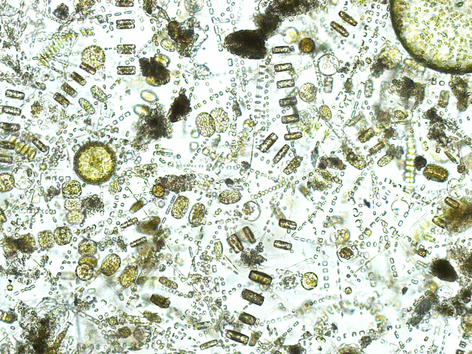 Diatoms, a type of plankton that can damage the gills of salmon. Photo: Scottish Association for Marine Science.