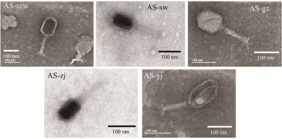 Morphology of phages AS-szw, AS-yj, AS-zj, AS-sw and AS-gz visualised in transmission electron microscopy. Source: Chen et al., 2018.