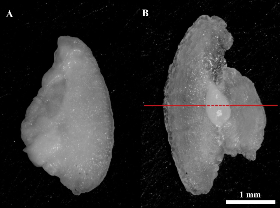 A normal (A) and a deformed (B) earbone. A is a normal earbone made of the typical aragonite form, while B is an earbone with an aragonite middle (dashed lines) with the solid red line showing where it has switched to the clearer vaterite crystal form. Photo: University of Melbourne