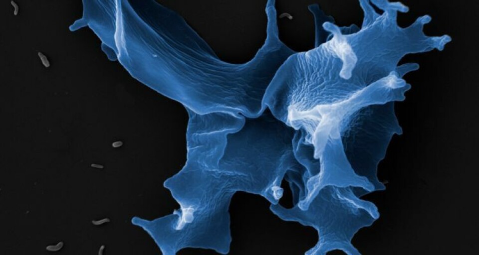 The amoeba Paramoeba peruan changes form by treatment with hydrogen peroxide (H202) and fresh water. This shape change is probably of great importance to the amoeba's ability to attack the gill tissue. Photo: Ms Wiik-Nielsen, the National Veterinary Institute.