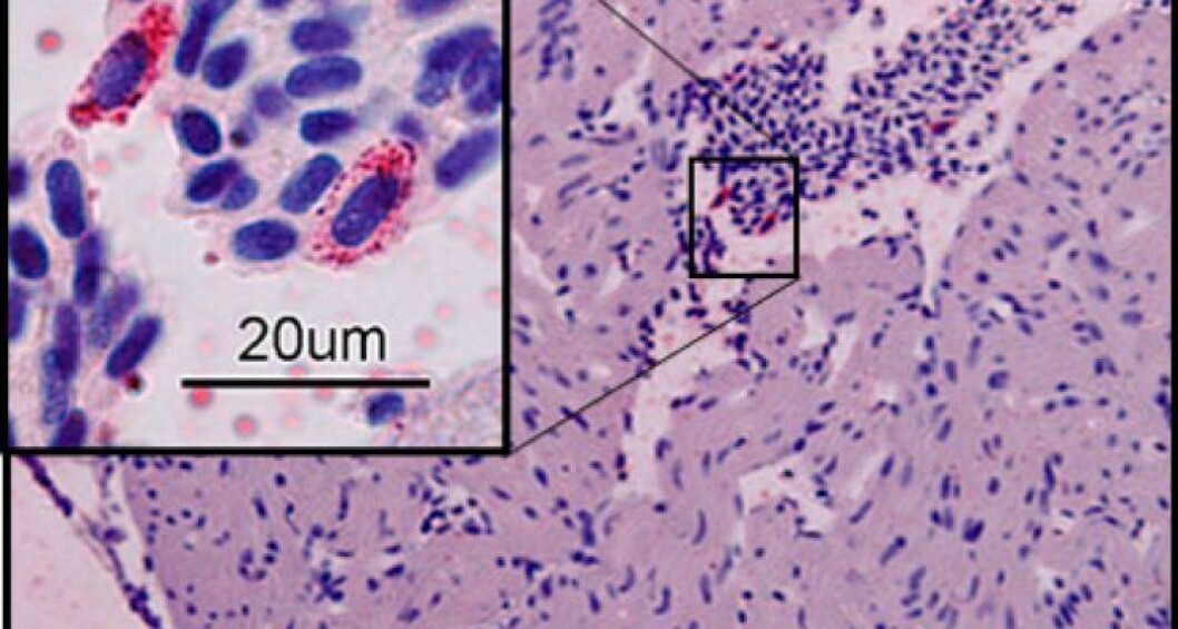 Staining of virus-infected sample from a vein from the heart. Photo: Torunn Taksdal Staining of virus-infected sample from a vein from the heart. Photo: Torunn Taksdal