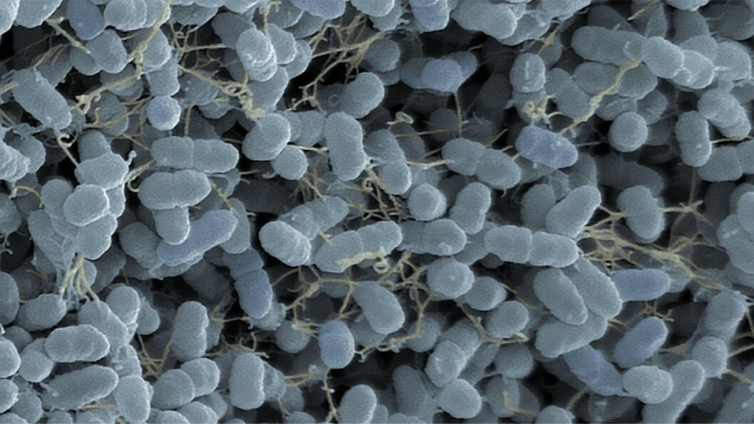 Y. ruckeri bacteria seen under a microscope. The bacteria are magnified 25,000 times and stained. Photo: Jannicke Wiik-Nielsen. Y. ruckeri bacteria seen under a microscope. The bacteria are magnified 25,000 times and stained. Photo: Jannicke Wiik-Nielsen.