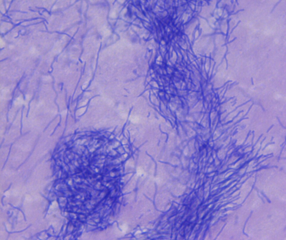 T. dicentrarchi, which has caused disease outbreaks in smolts in land-based seawater farms. Photo: Henning Sørum