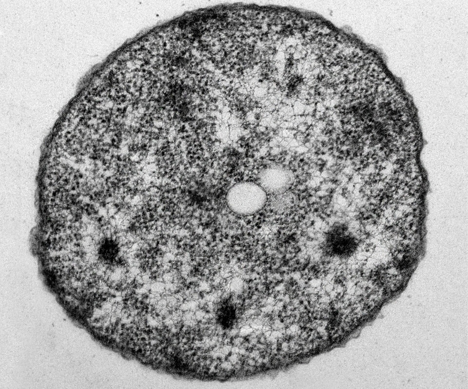 Transmission electron microscopy (STEM) of P. salmonis 005 grown in Austral SRS broth medium.