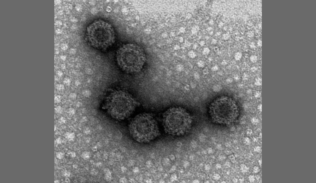 The PRV virus viewed through an electron microscope. A study from NMBU Veterinary College shows that different PRV variants have different abilities to cause inflammation of the heart and skeletal muscle in salmon. Photo Øystein Wessel / NMBU Veterinary College The PRV virus viewed through an electron microscope. A study from NMBU Veterinary College shows that different PRV variants have different abilities to cause inflammation of the heart and skeletal muscle in salmon. Photo Øystein Wessel / NMBU Veterinary College